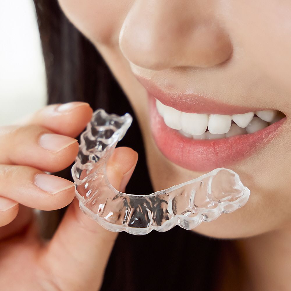 클리움 [1+1]이갈이 방지 마우스피스 클리움 가드 나이트 수면용 스플린트